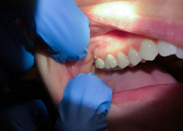 Best Emergency Treatment for Jaw Pain or Injury in Lewiston, CA