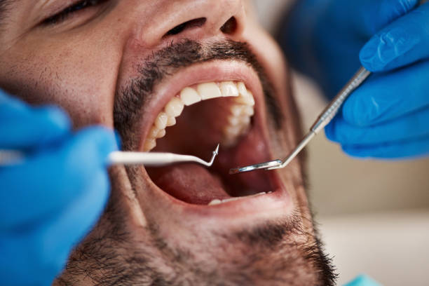 Best Broken or Chipped Tooth Repair in Lewiston, CA